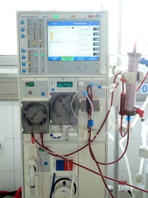 血液透析机